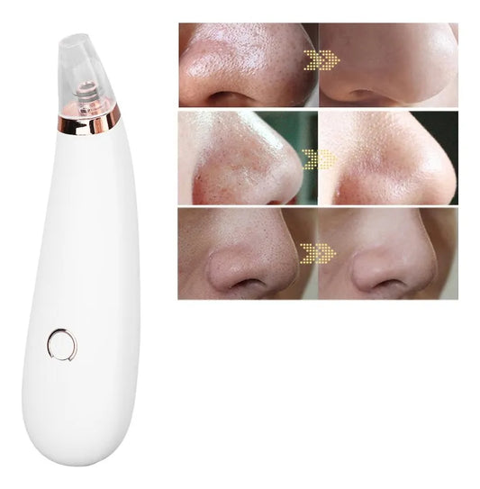 Limpiador Facial- Limpiador de Poros