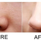 Limpiador Facial- Limpiador de Poros
