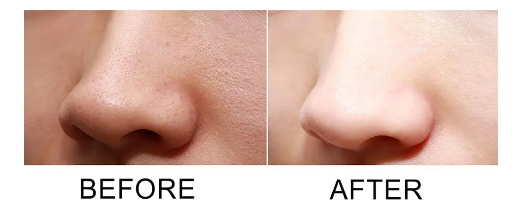 Limpiador Facial- Limpiador de Poros